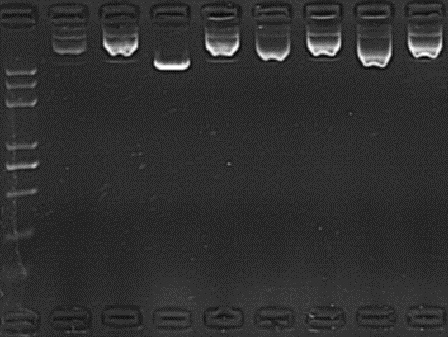 质粒提取诡异大条带-2