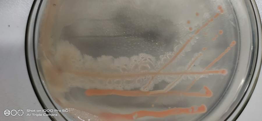 细菌鉴定,急急急!!!-1